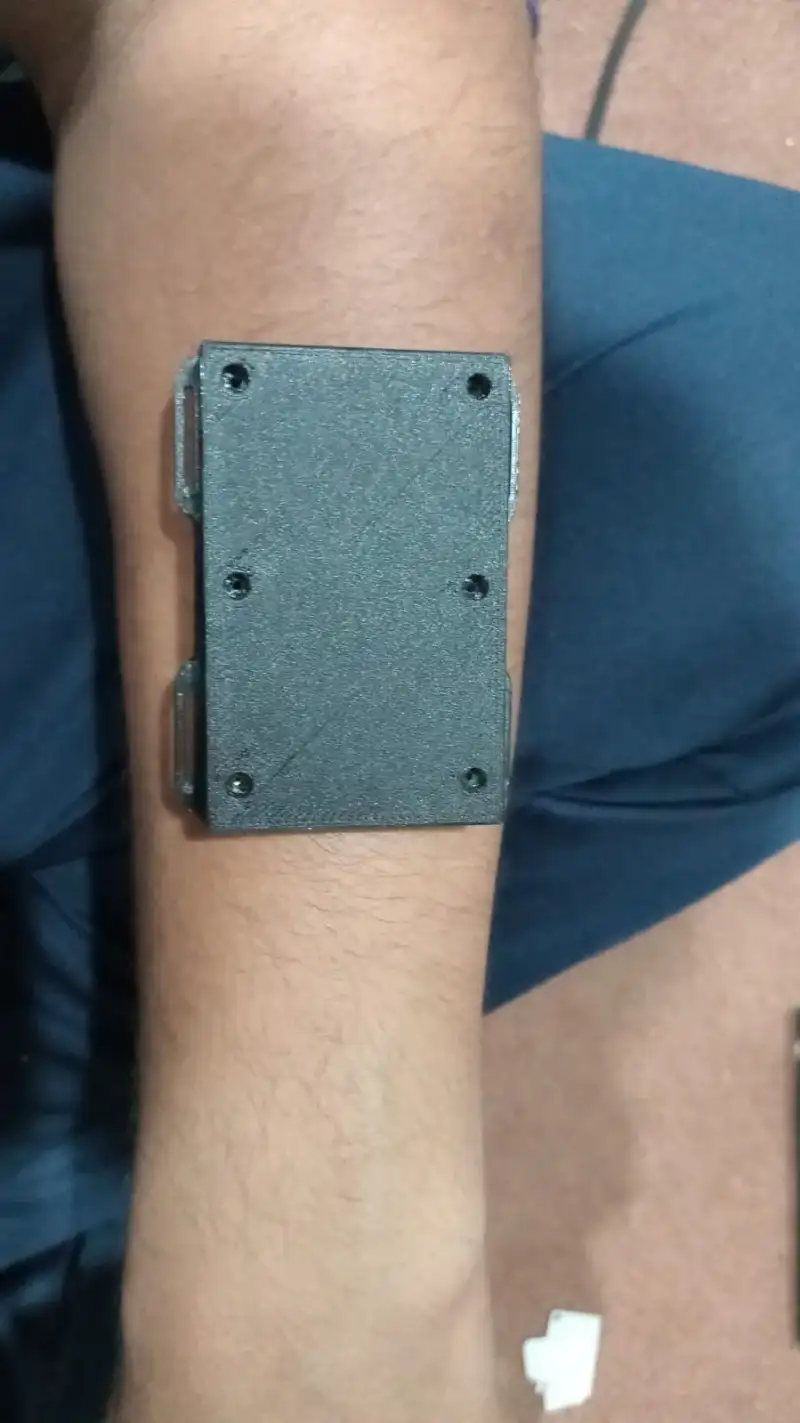 The printed enclosure strapped to an upper arm.